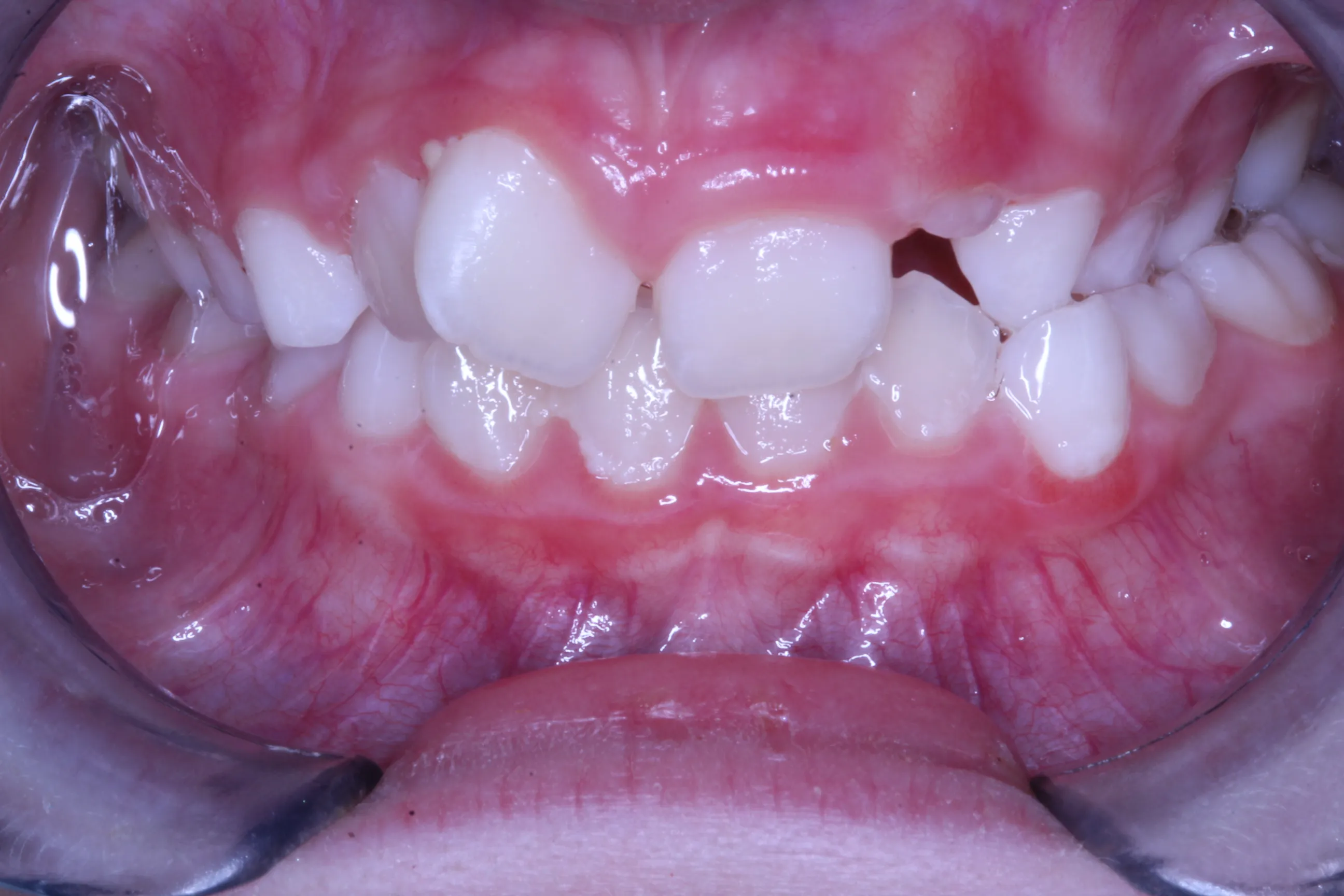 smile-gallery gallery